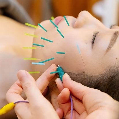美容鍼灸と最新エステメニューの融合施術によるトータルケア